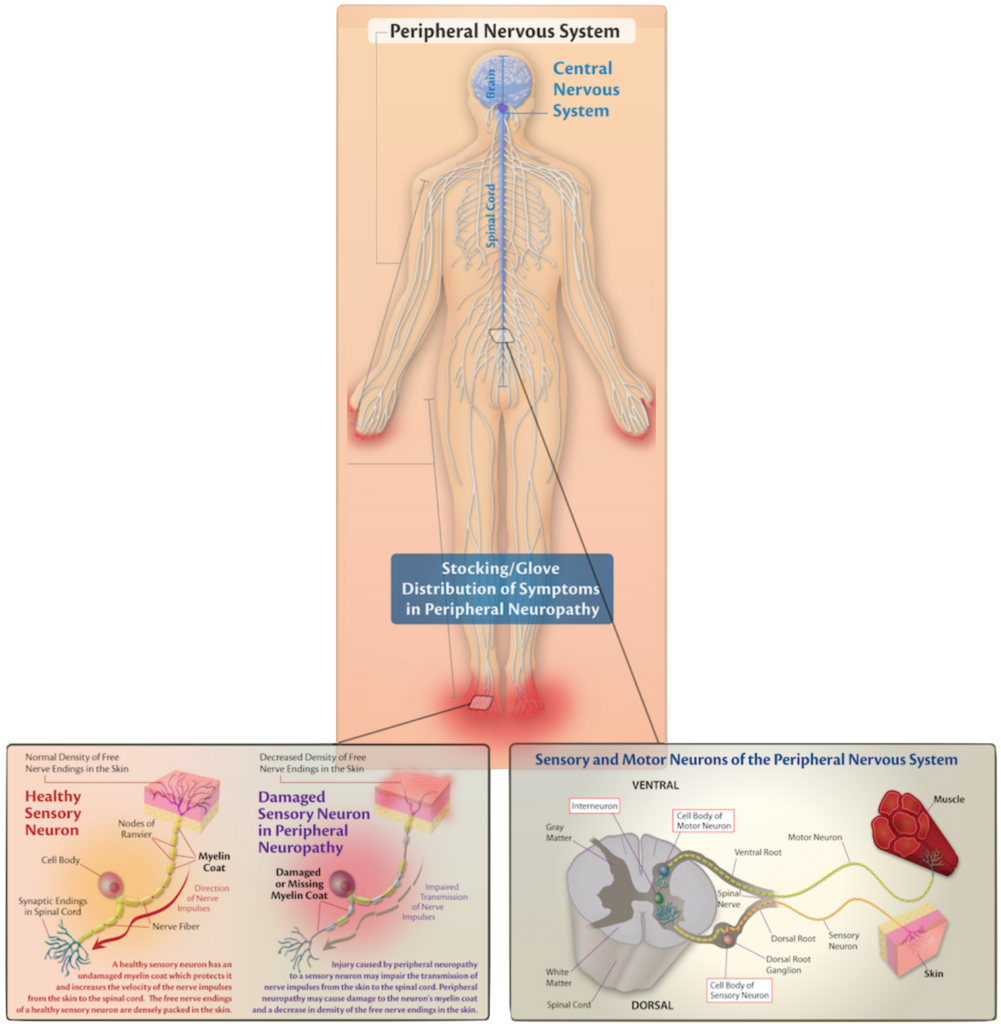 about-peripheral-neuropathy-dr-richard-h-mann