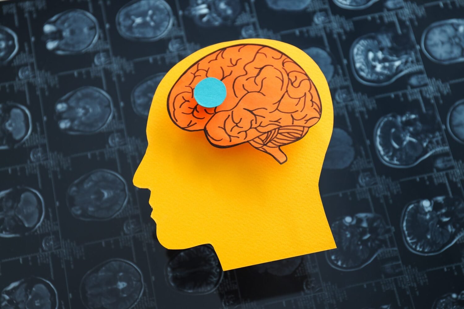 Paper cutout silhouette of a human head with a hand-drawn brain and a blue dot, layered over MRI scan images.