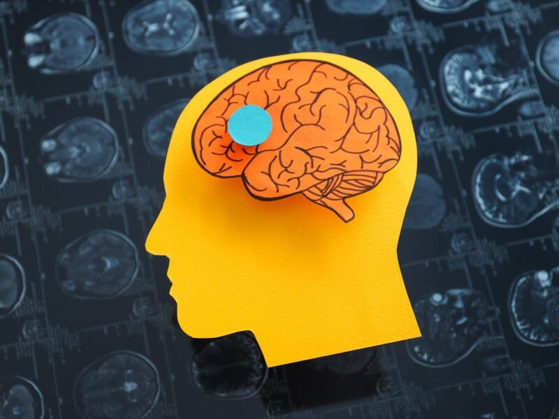 Paper cutout silhouette of a human head with a hand-drawn brain and a blue dot, layered over MRI scan images.